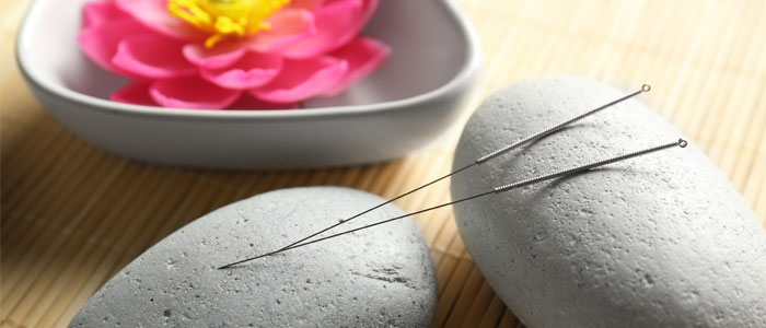 acupuncture needles resting on two stones